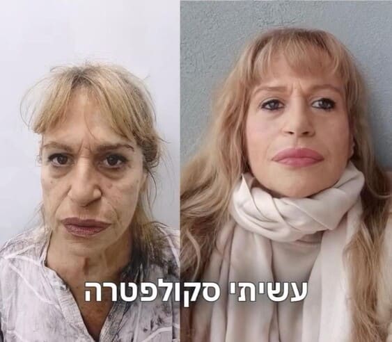 ביו-סטימולטורים, תמונה מתוך גלריית המרפאה, להמחשה כללית